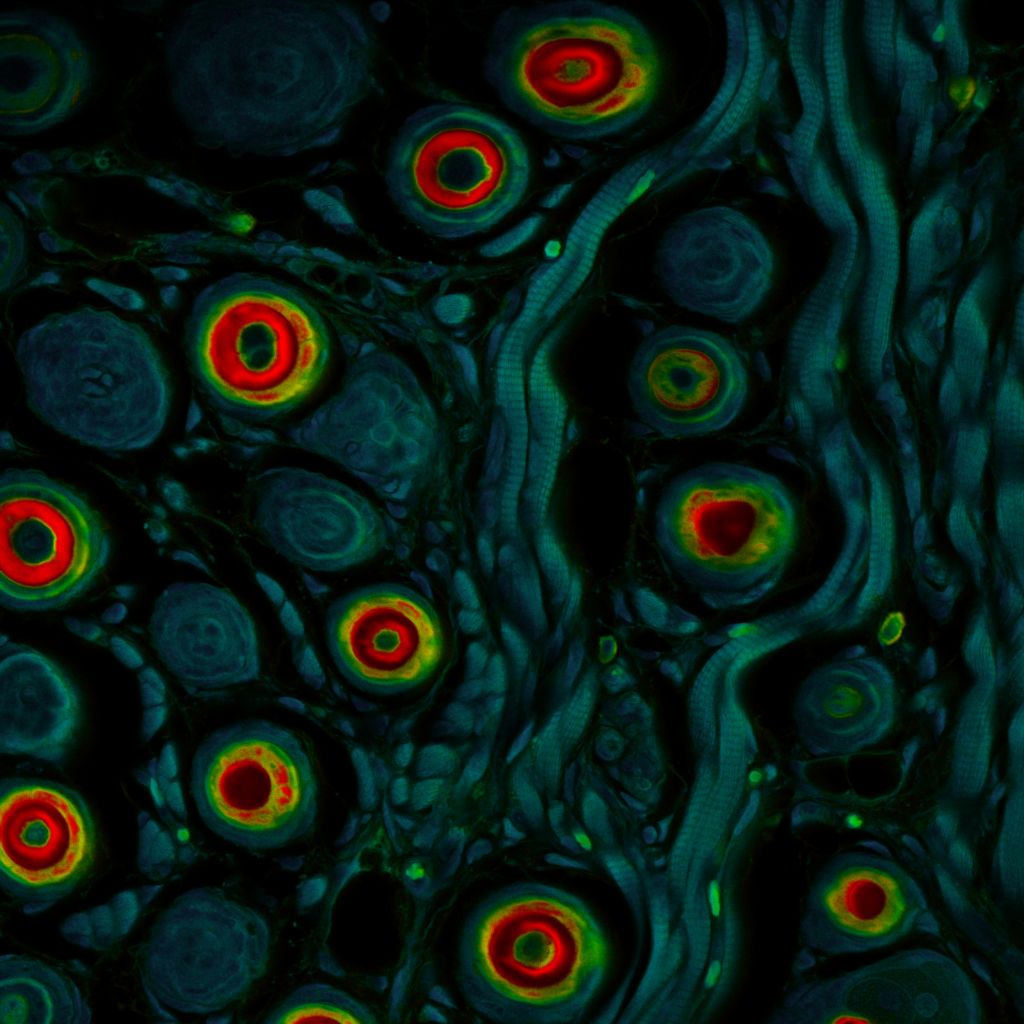 FLIM image of mouse tissue displaying distinct fluorescence lifetime gradients associated with metabolic differences across the sample.