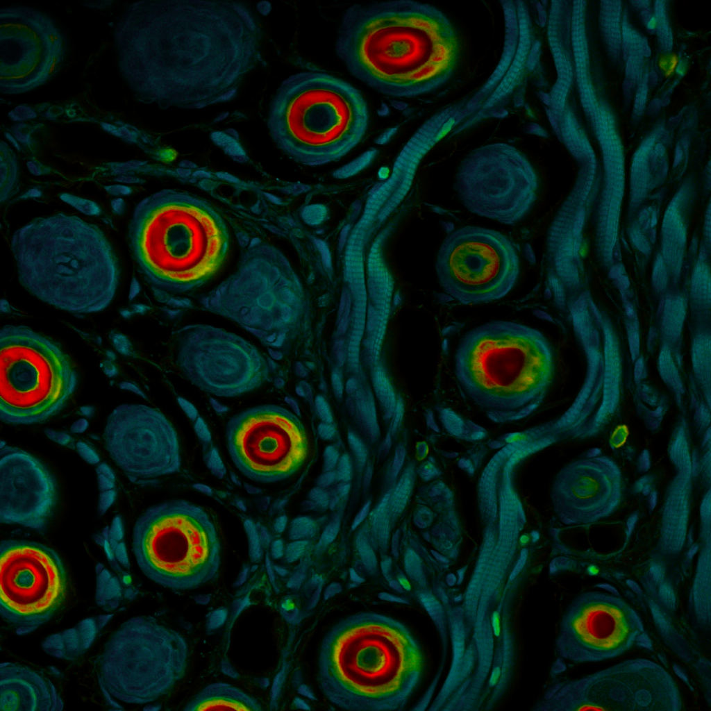 Fluorescence lifetime imaging microscopy of mouse tissue showing gradient in lifetime values across tissue regions.