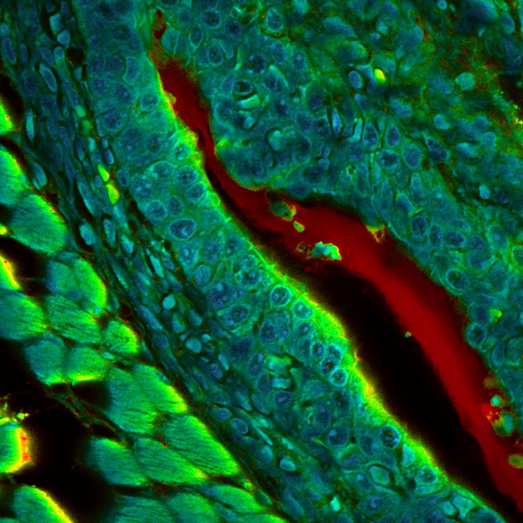 FLIM image of mouse tissue revealing spatial heterogeneity in fluorescence lifetime related to cellular composition and metabolic activity.