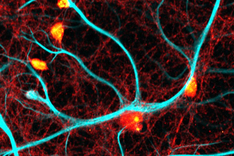 Fluorescence lifetime imaging microscopy (FLIM) of fixed neurons showing synaptic protein PSD95 and glial intermediate filament GFAP, revealing structural organization in neuronal cells.