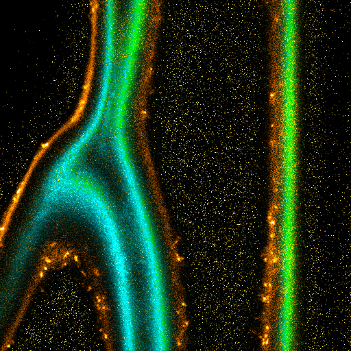 Fluorescence lifetime imaging microscopy of onion skin stained with di-4-ANEPPDHQ separating membrane fluorescence from autofluorescence using lifetime pattern matching.
