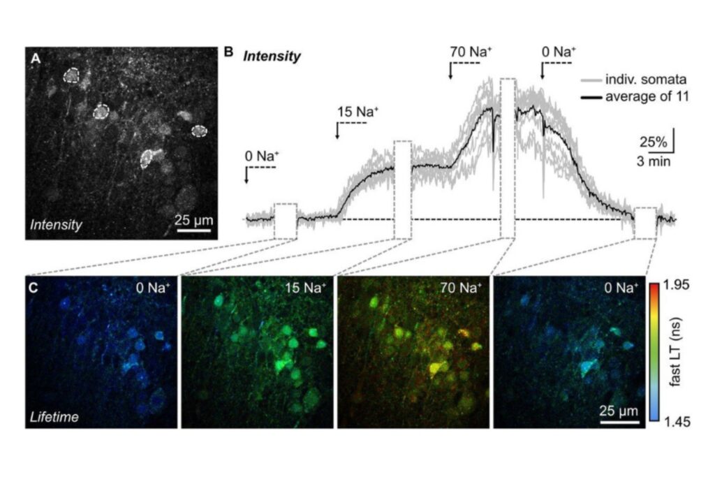 Fluorescence lifetime imaging of hippocampal brain slices showing intracellular sodium dynamics measured with the ING2 sensor during neuronal activity.