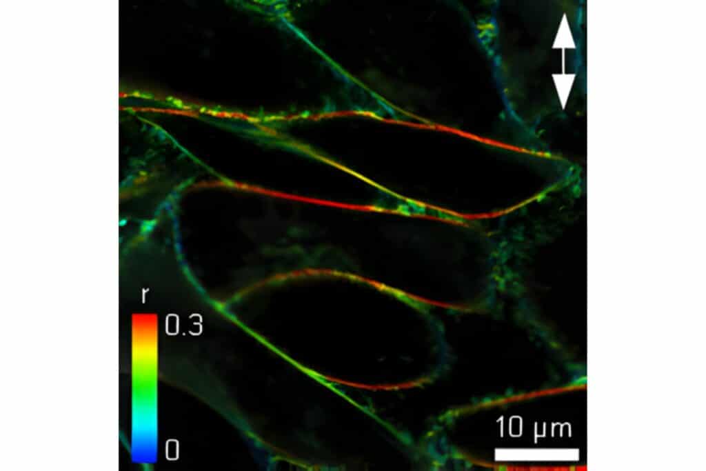 Anisotropy image of C6-NBD-PC labeled CHO cell membranes