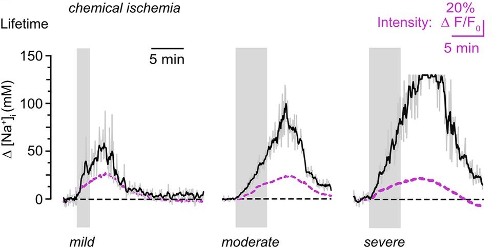 Time course of intracellular sodium concentration during mild, moderate, and severe chemical ischemia comparing lifetime-based measurements with fluorescence intensity signals.