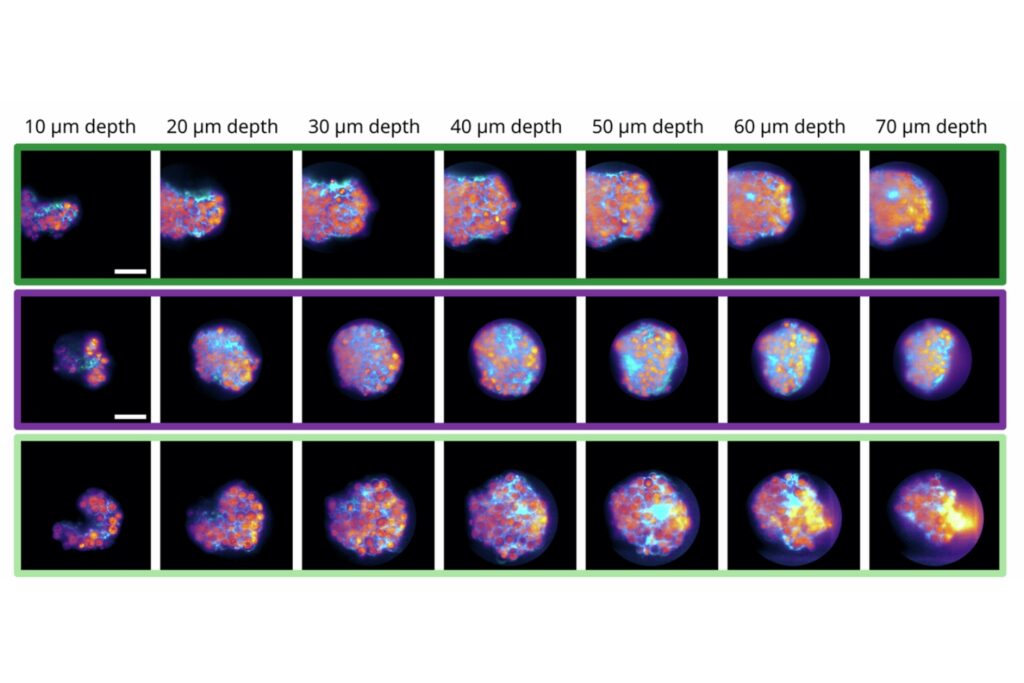 Volumetric fluorescence lifetime imaging (FLIM) of organoids at different depths showing 3D lifetime distribution using light-sheet microscopy
