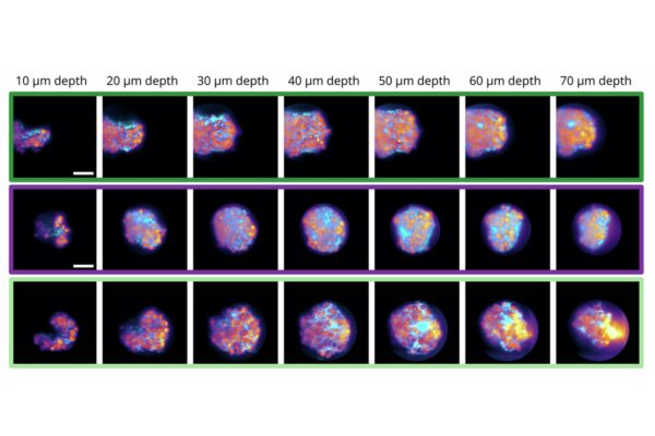 High-Speed FLIM for Volumetric Live Imaging | PicoQuant