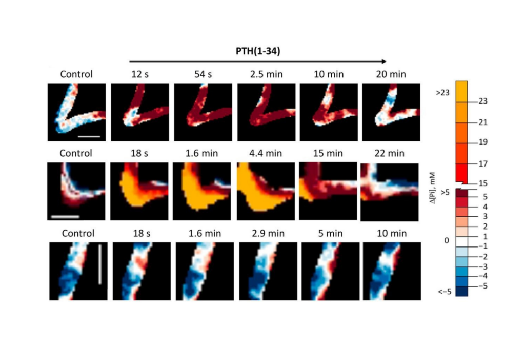 Time-lapse fluorescence lifetime imaging reveals hormone-induced intracellular phosphate dynamics in living cells after parathyroid hormone stimulation.