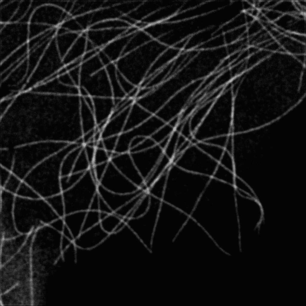 High-contrast microtubule image after ISM processing with computational sectioning removing out-of-focus light