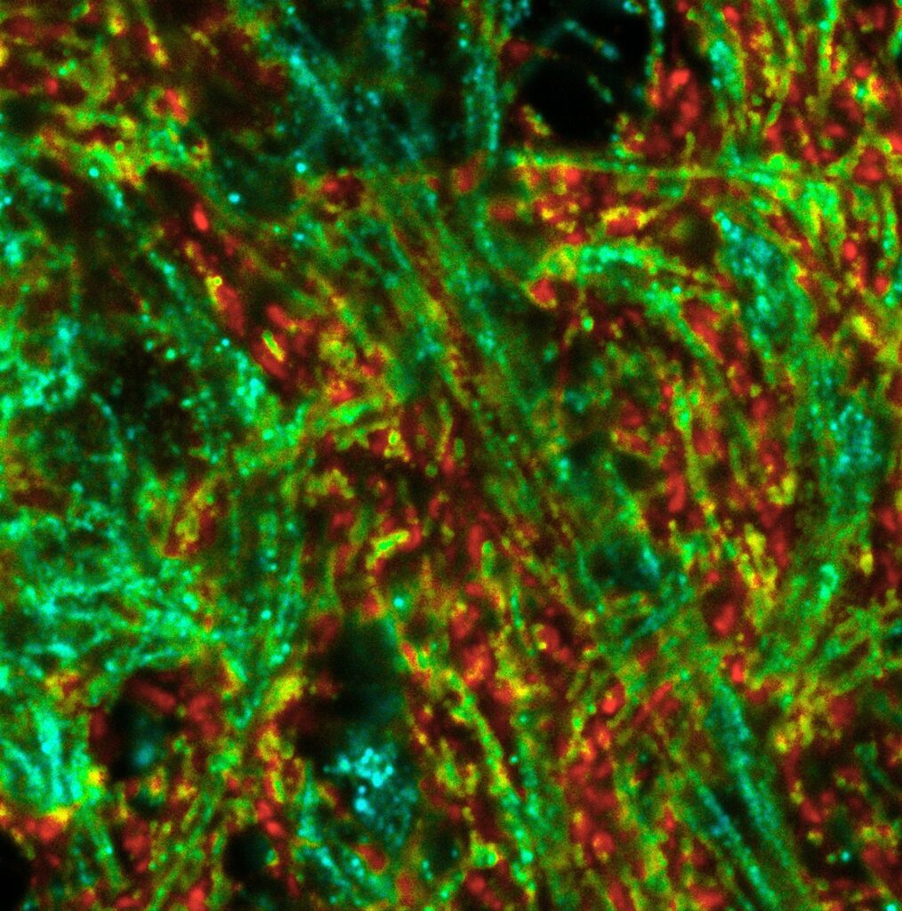 ISM-FLIM image of neuronal hippocampal culture showing lifetime contrast of TOM20 and SYPT1 markers