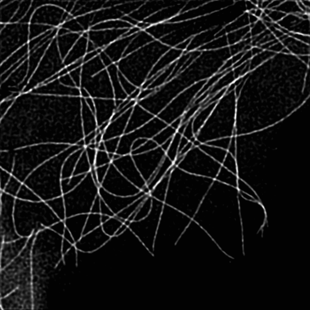 High-resolution microtubule image after ISM processing with computational sectioning and Lucy–Richardson deconvolution