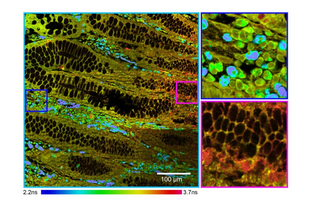 Autofluorescence fluorescence lifetime imaging microscopy (FLIM) of human intestinal tissue revealing spatial metabolic heterogeneity through distinct lifetime distributions across different regions of interest.