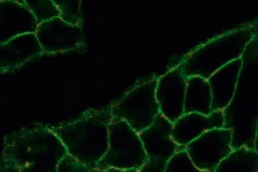 Fluorescence lifetime imaging of MDCK cell membranes labeled with the tension probe Flipper-TR visualizes membrane tension changes during osmotic stress in mechanobiology experiments.