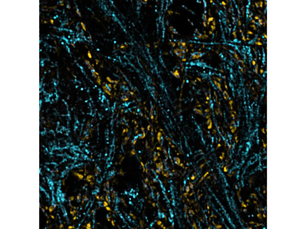 ISM-FLIM image after deconvolution showing lifetime-based multiplexing of SYPT1 and TOM20