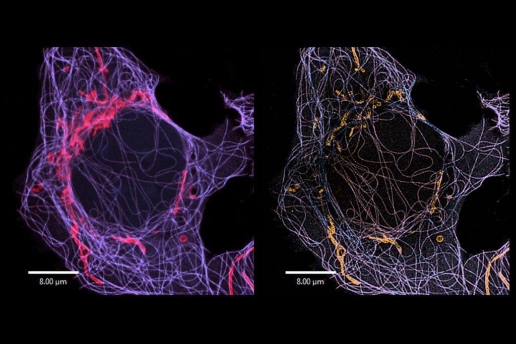 ISM-FLIM species separation of mitochondria and microtubules in U2OS cells