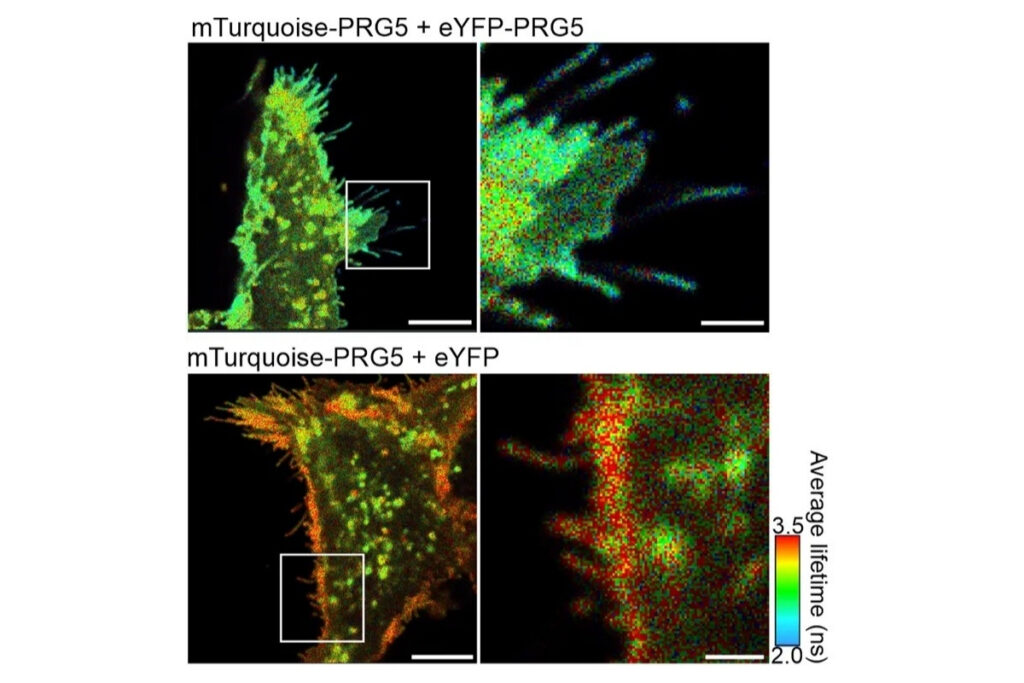 FLIM-FRET lifetime map showing reduced donor lifetime of PRG5 at the plasma membrane and in filopodia of HEK293T cells.