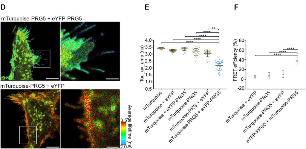 FLIM-FRET lifetime maps and quantification showing reduced donor lifetime and increased FRET efficiency of PRG5 in spine-like protrusions of primary hippocampal neurons.
