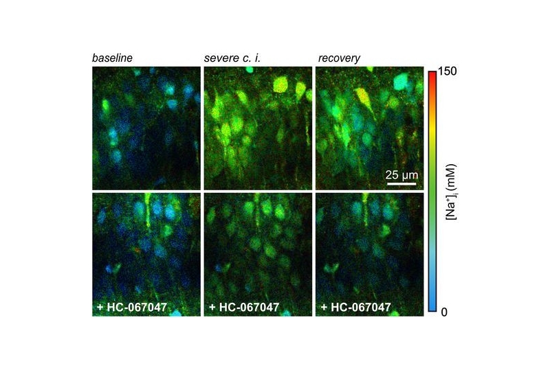 Fluorescence lifetime imaging maps of intracellular sodium concentration in hippocampal neurons during baseline, severe chemical ischemia, and recovery, with and without TRPV4 inhibition.