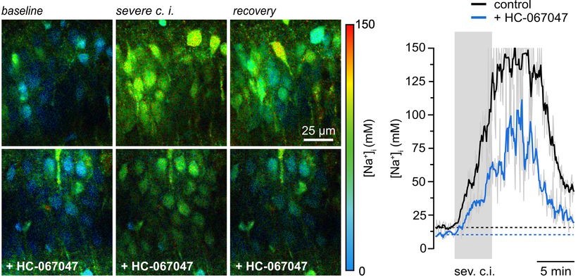 Time course of intracellular sodium concentration during mild, moderate, and severe chemical ischemia comparing lifetime-based measurements with fluorescence intensity signals.