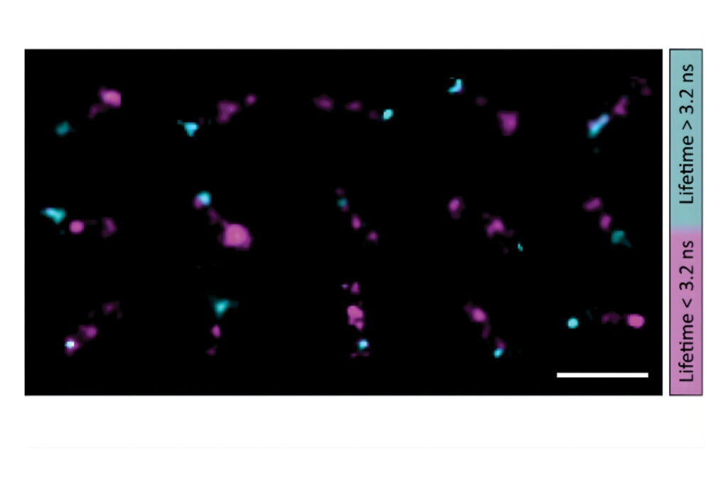 Super-resolved FLIM image of DNA origami structures showing lifetime-based discrimination of FRET and non-FRET events.