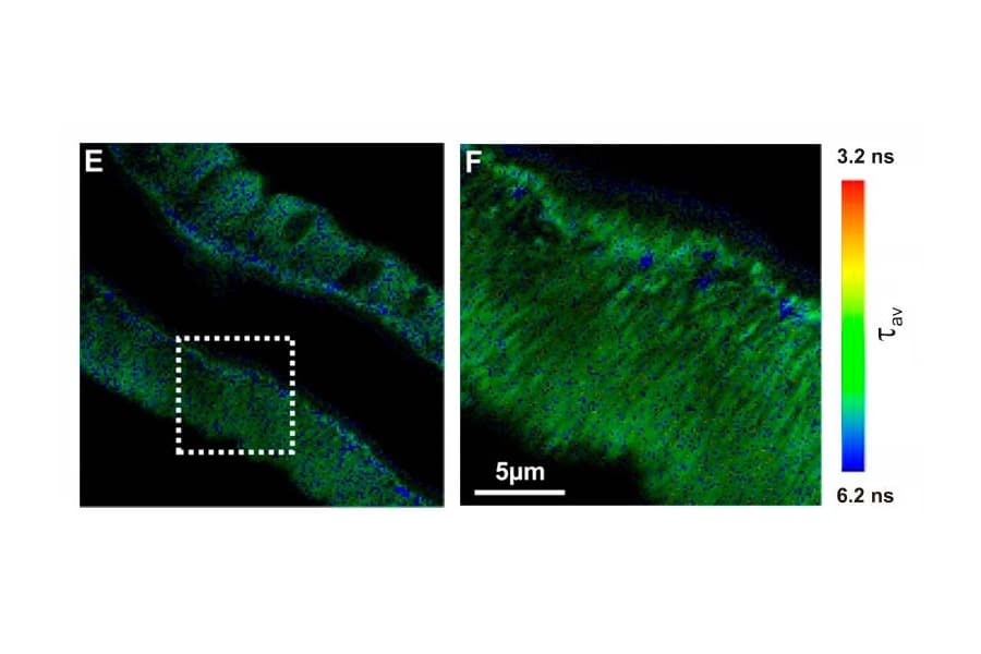 Two-photon FLIM image of tissue with lifetime contrast